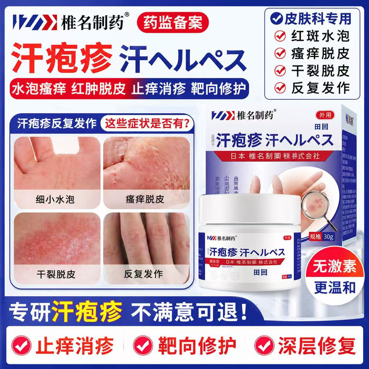 汗疱疹止痒根去用膏手癣药膏医用真菌专感染水泡湿效疹脱皮肤特LT