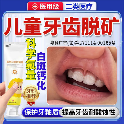 儿童牙齿脱矿专用牙膏涂氟白斑钙化专用含氟再矿牙釉质修复敏感GX