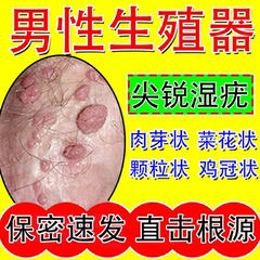 男性生殖器尖锐湿疣专用膏hpv去疣根鬼臼私处肛门克星软膏日本GX