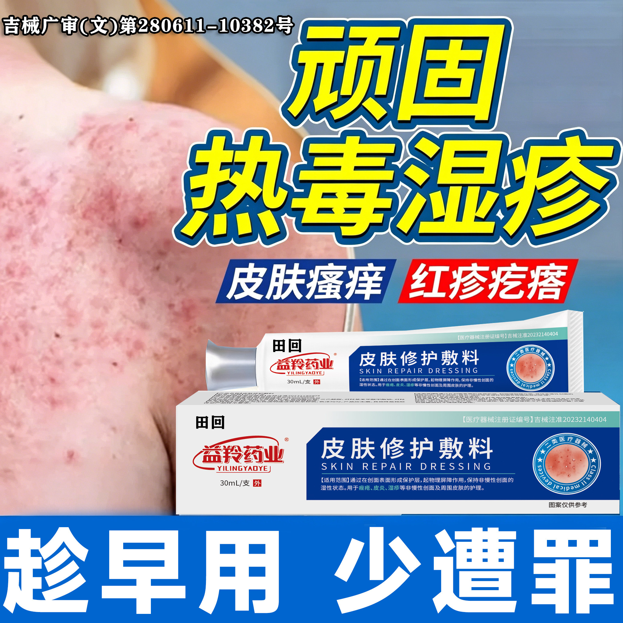 热毒湿疹止痒膏湿毒清软膏祛根湿皮肤一热就痒顽固皮炎真菌感染LT