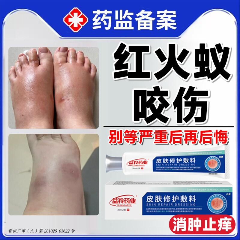 红火蚁咬伤药膏蚂蚁叮咬瘙痒止痒消肿过敏蚊虫毒隐翅虫专克星用gx