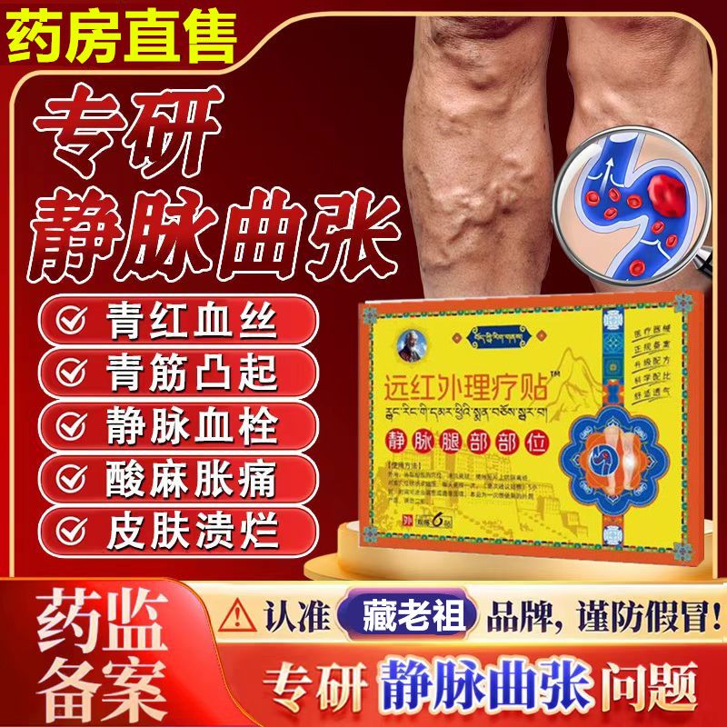 藏家古方静脉曲张贴蚯蚓腿血管肿胀红血丝腿部青筋凸起老祖医用贴