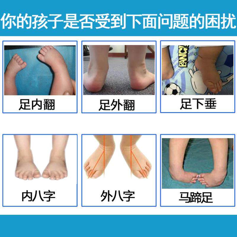 婴儿矫正器鞋儿童足内八字外翻马蹄下垂足托脚踝纠正