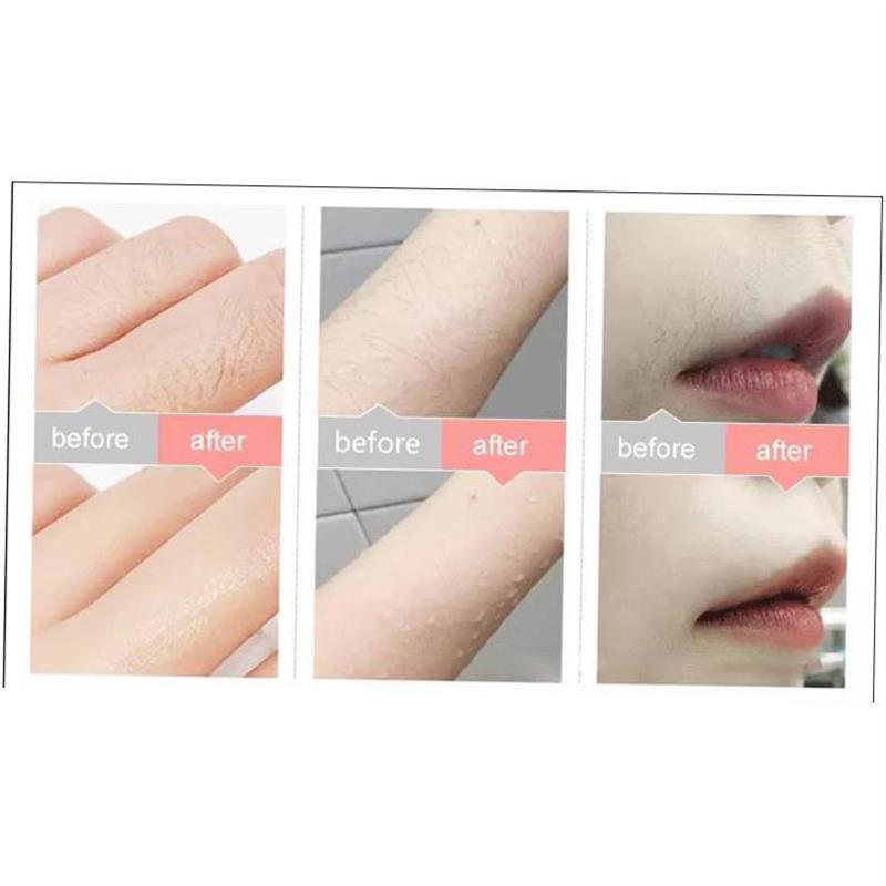 Laser Epil Permaet IPL Hr Remov electr shavig1