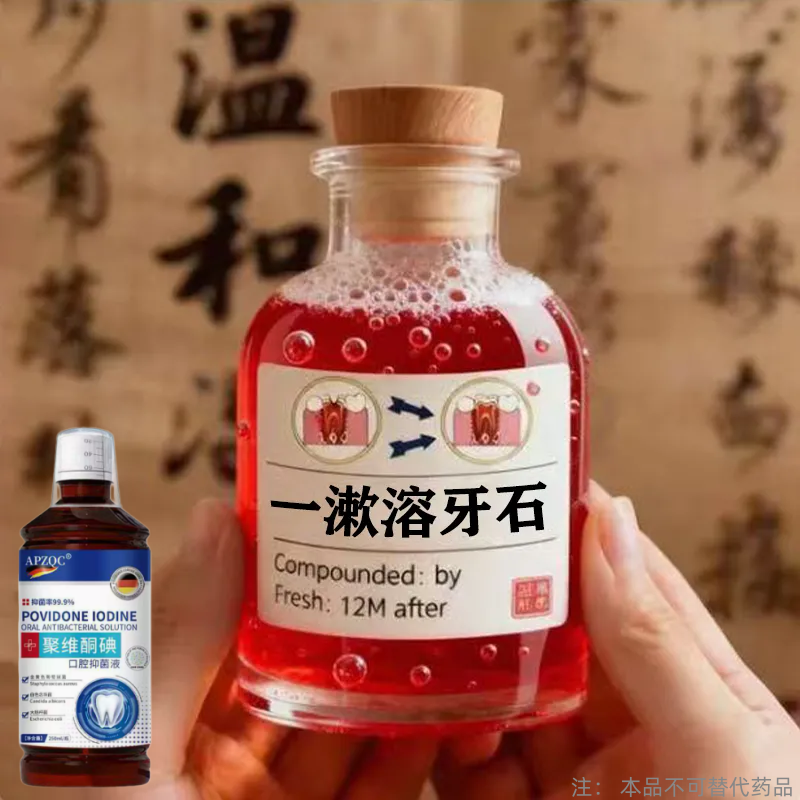 【2026断货王】牙石溶解漱口水洗牙齿污垢牙垢牙黄牙渍清理神器