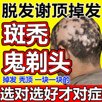 【俊宏】固肾生发丸140mg*144粒/盒