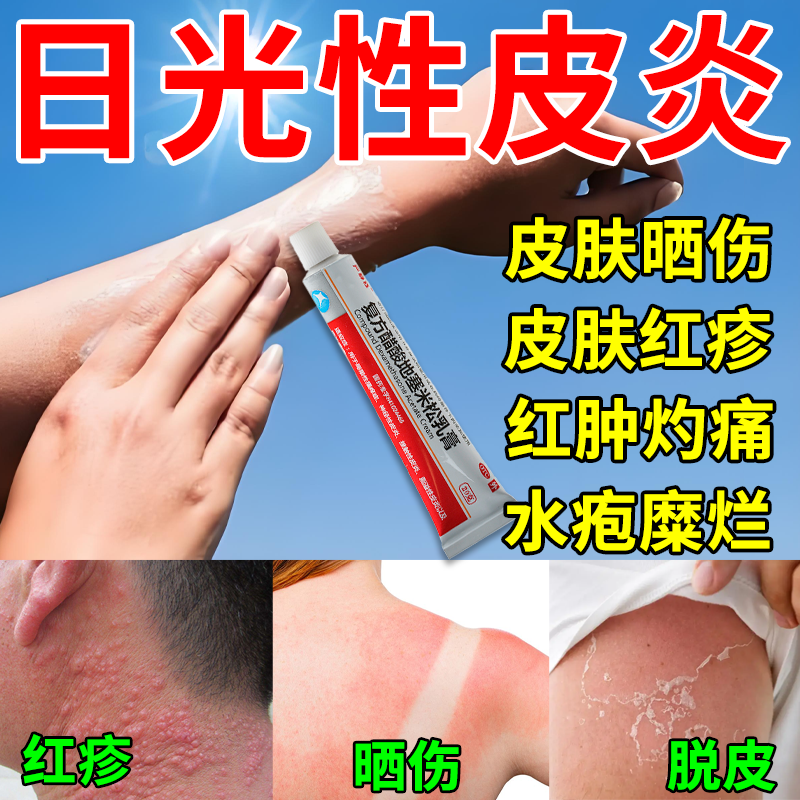 日光性皮炎紫外线过敏皮肤晒伤修复皮肤瘙痒干燥起皮水泡止痒抑菌