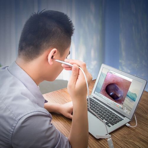 速发.mm可视耳镜安镜合口可视采耳内窥卓.毫米耳鼻1腔显微镜