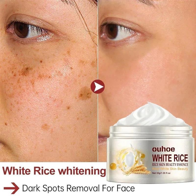 White Rice Face Whitening Cream Remove Dark Spots Fade Freck