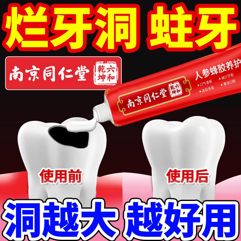 【牙医推荐】防止蛀虫 告别蛀牙 牙齿黑窟窿 蛀牙修复牙洞黑转白