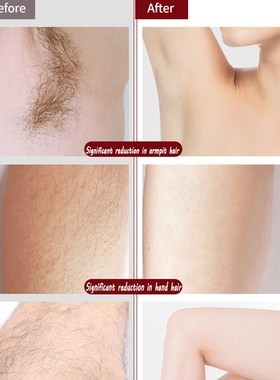 2 In 1 Hair Removal Machine Ladies Shaver Plucker Electric E