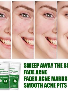 36Pcs Acne Pimple Patch Invisible Waterproof Absorb Pus Acne