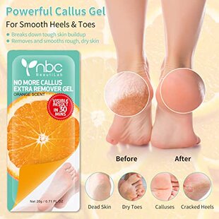 Callus Remover for Feet  Callus Remover Gel No More Callus P