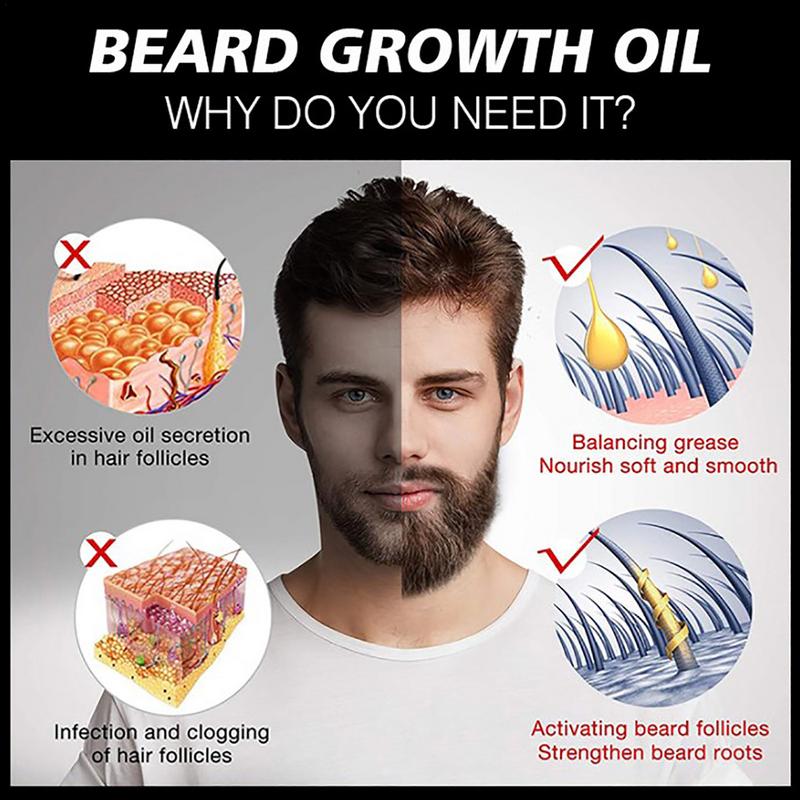30 Ml Beard Oil Beard Oil For Men Thicker Facial Hair Growth