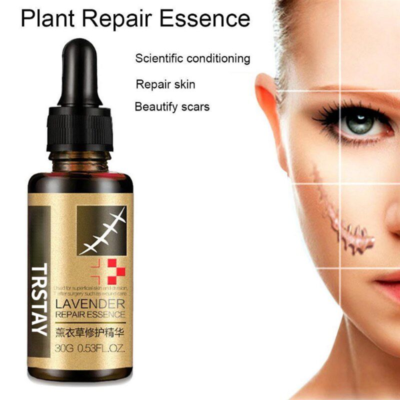 Lavender Repair Essence Scar Removal Scar  Essential Massage