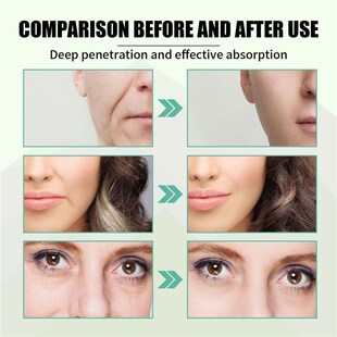 Facial Serum Whitening Skin Fine Lines Effective