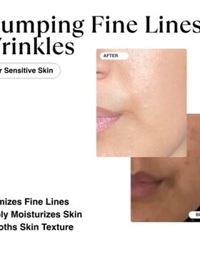 极速MATKAS Korean Triple Pure Hyaluronic Acid Serum for Face