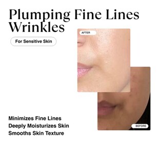 Pure Face 极速MATKAS Triple Serum for Acid Korean Hyaluronic