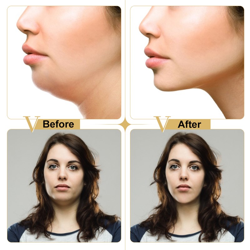4D V-shape Lifting Face Mask Ear Hanging Chin Cheek Lift Fac