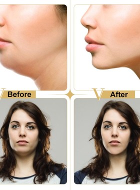 4D V-shape Lifting Face Mask Ear Hanging Chin Cheek Lift Fac