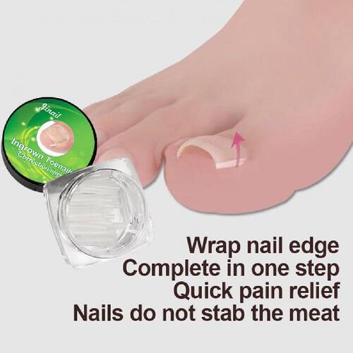 极速Ultra Thin Plastic Hot Sale 10Pcs/Box Nail Correction