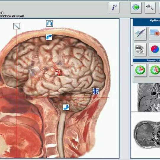 2024 latest 18d nls hunter 4025 nls health analyzer