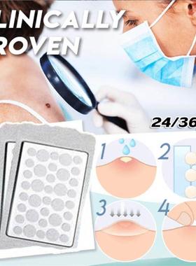 Skin Tag Remover Patch Pimple Wart Treatment Cream Quick Ab