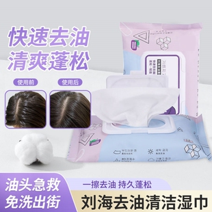 浏海去油湿巾免洗头发去油神器吸油纸清洁去头油蓬松湿巾可携式小