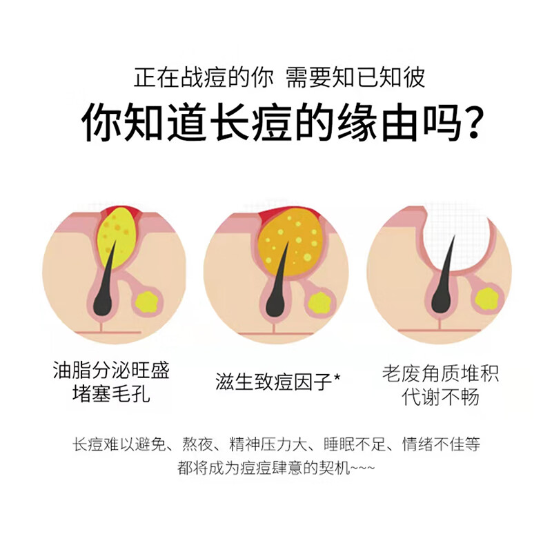 下巴反复脸上长痘痘用什么药淋巴腮边痘红肿结节硬块痘玫瑰痤疮膏