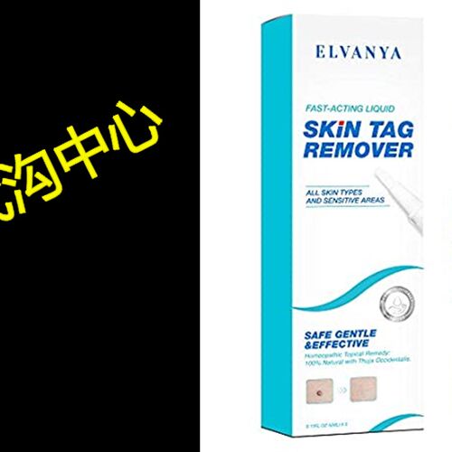 极速Skin Tag Remover - Wart Remover- Mushroom Cookies & P