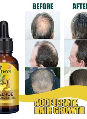 Ginger Hair Growth Products Fast Growing Hair Essential Oil