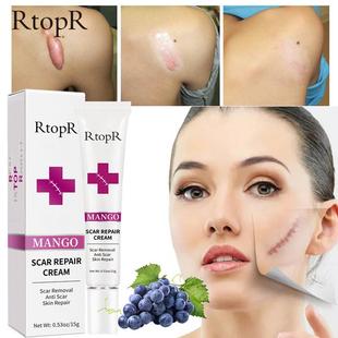 Remo??o da cicatriz gel remover desaparecer pele escura an