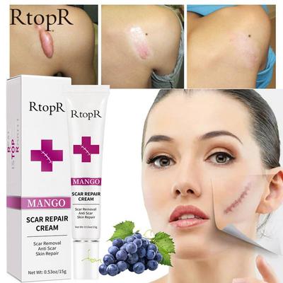 Remo??o da cicatriz gel remover desaparecer pele escura an