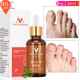 Nail Essence Treatment Fungal Feet Care Foot Whitening