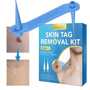 1 Set Blue Skin Tag Removal Kit Home Use Mole Wart Remover E