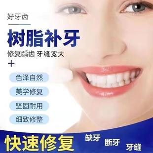 自己补牙洞神器材料牙缝缺牙门牙洞假牙套烤瓷牙洞贴