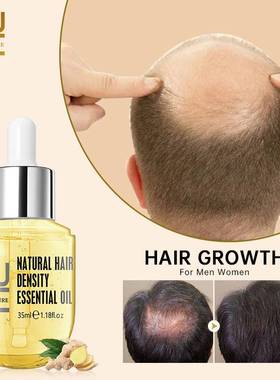 Ginger Essentials Hair Growth Sprays Products For Men Women
