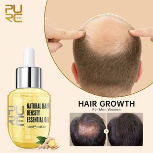 Growth Sprays Products Ginger Men Hair For Women Essentials