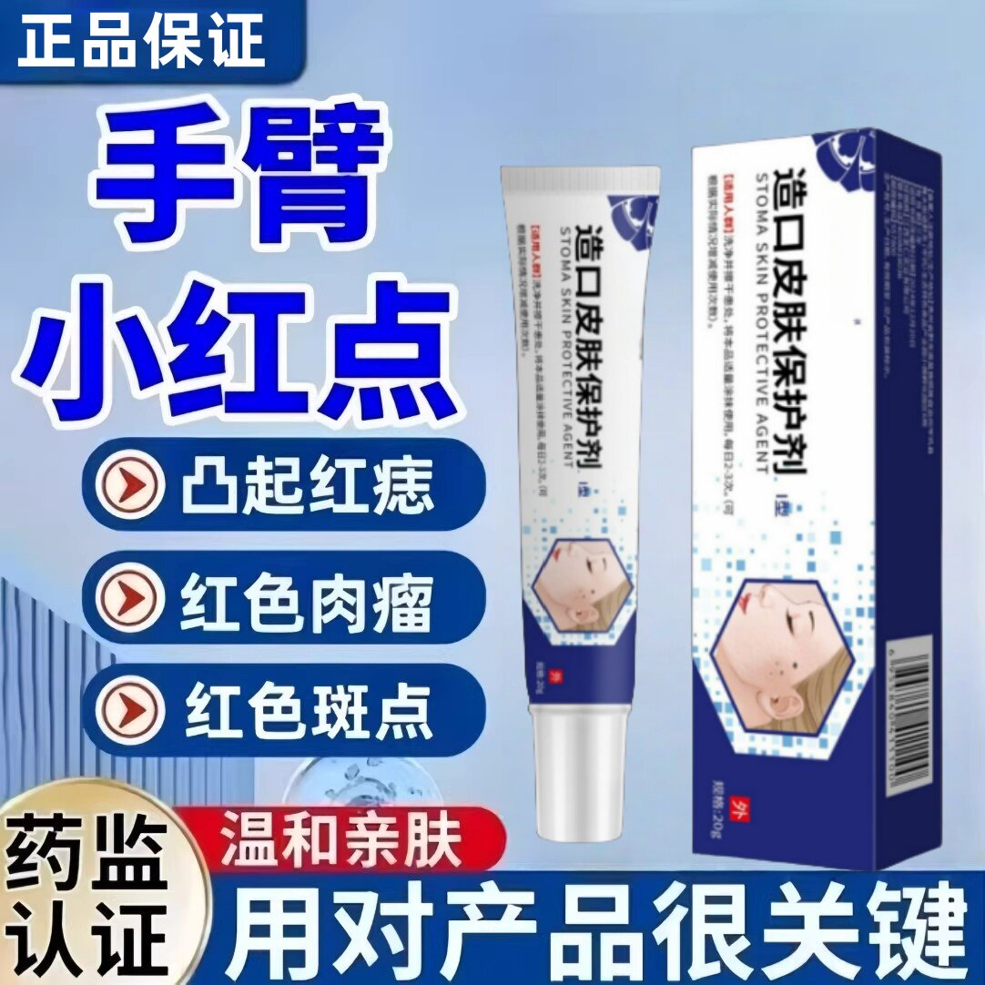 造口皮肤保护剂手臂小红点血管痣凸起红痣红色肉瘤红色斑点正品