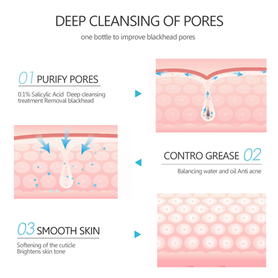 Blackhead Remover Salicylic Acid Face Mask Facial Cleansing