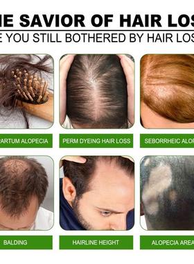 New Ginger Hair Growth Products Fast Growing Hair Essential