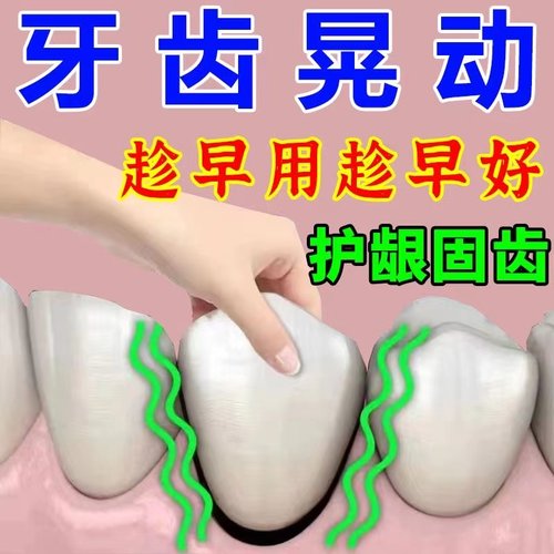 【趁早用趁早好】牙齿松动牙龈委缩牙晃动出血肿痛修复固齿牙膏YX
