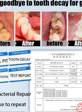 Quickly Repair of Cavities Caries Mousse Teeth Clean Whiten