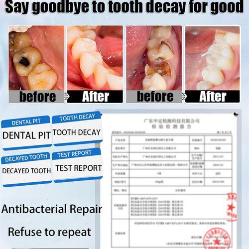 Quickly Repair of Cavities Caries Mousse Teeth Clean Whiten