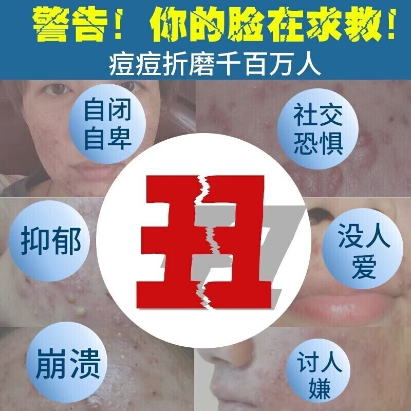 痘痘修复消炎祛痘印痘坑凹洞毛孔粗大后背痘印淡化消印男士仪器霜