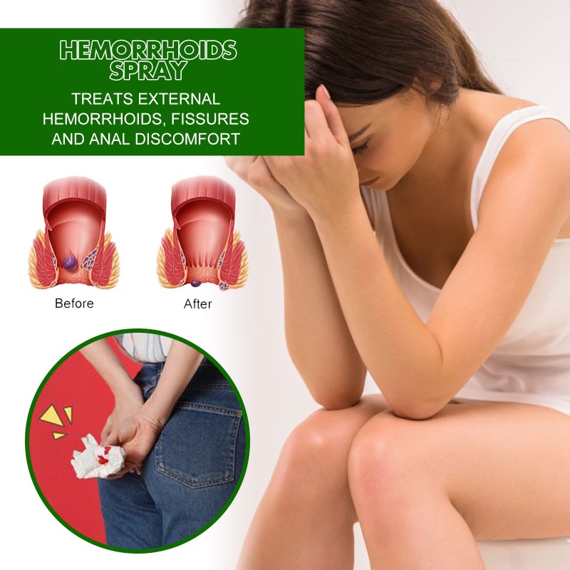 Herbal Hemorrhoids spray relieves anal Fissure Pain itching
