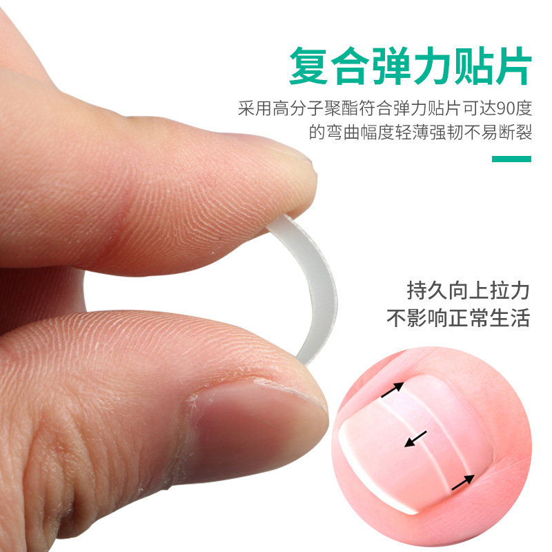 好货甲沟矫正贴嵌甲矫正器正甲贴脚趾甲贴片矫正指甲剪钳修脚刀套