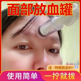 面部泄血罐放血罐脸部拔罐器拔青春痘粉刺吸罐手拧吸力大力度美容