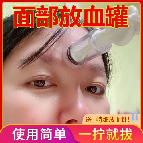 面部泄血罐放脸拔器青春痘