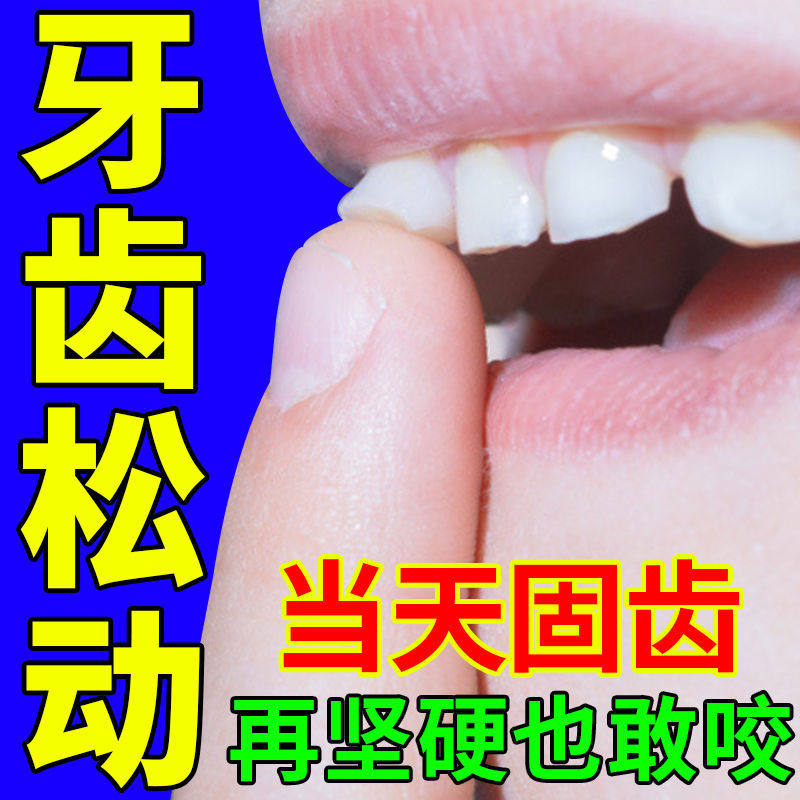 牙齿松动固定器固齿修复牢牙散固牙药护理牙齿松动牙结石牙周炎胶